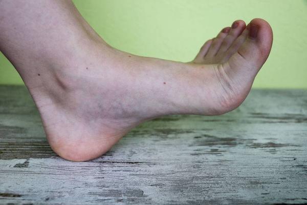 如何判断脚痛的原因（或与5个因素有关）(6)